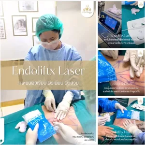 Endolift X laser Dr.Aomthongclinic ออมทองคลินิก