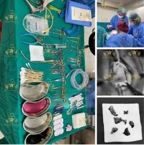 ผ่ารีแพร์ ตกแต่งเลเบีย Dr.Aomthongclinic ออมทองคลินิก 3