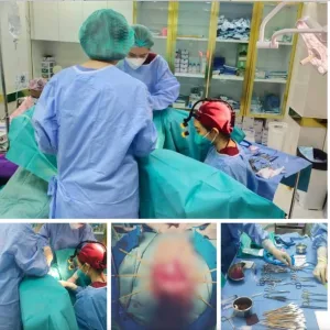 ผ่ารีแพร์ ตกแต่งเลเบีย Dr.Aomthongclinic ออมทองคลินิก