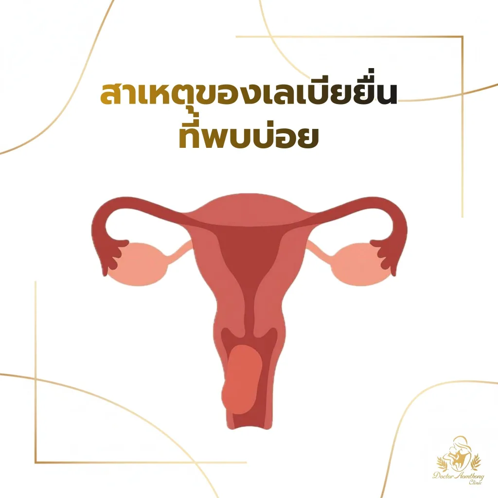 อินโฟกราฟิกแสดงสาเหตุของเลเบียยื่นที่พบบ่อยในผู้หญิง